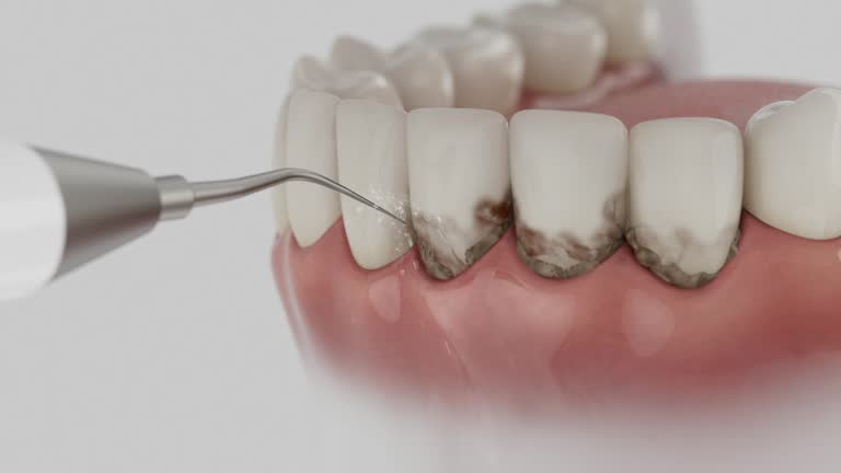 Trusted Emergency Dentist service in Avondale Estates, GA - Dentist Open Now